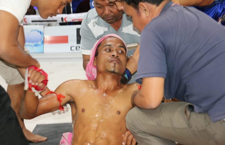 noun rathen lost chance at boxing contest at tv5 admid injury